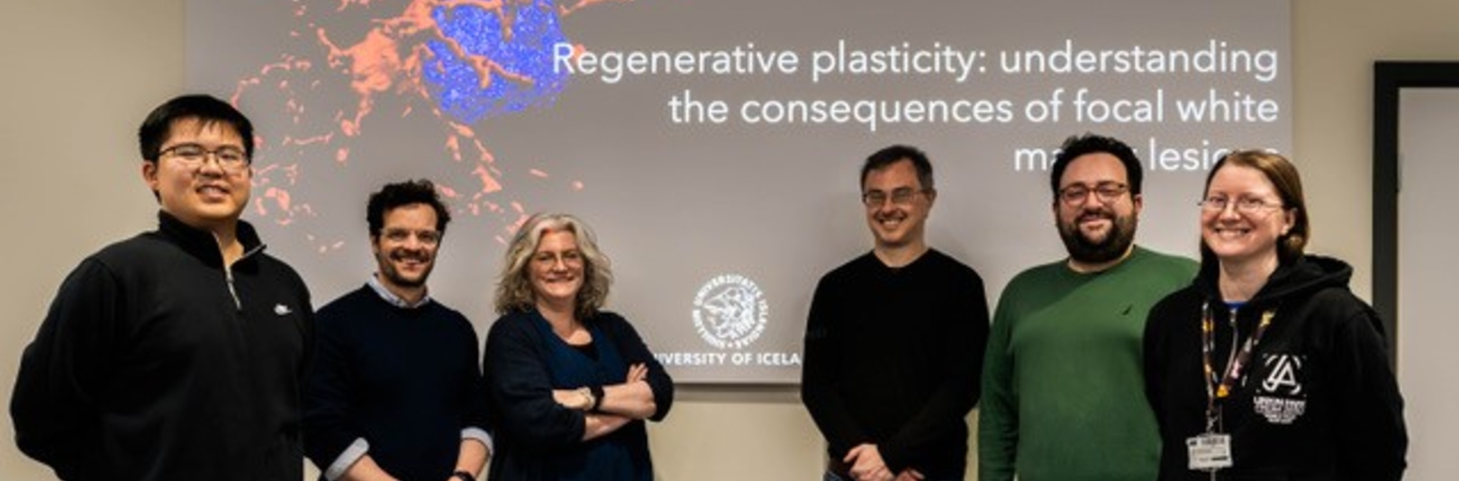 Skemmdir í hvíta efni heilans gætu ýtt undir einkenni sem tengjast heilabilunarsjúkdómum  - á vefsíðu Háskóla Íslands